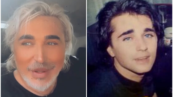 Scialpi Malattia