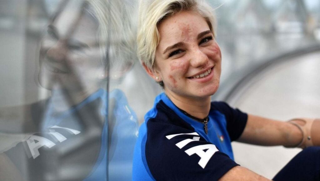 Quando si sposa Bebe Vio?